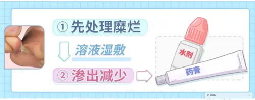 详细介绍