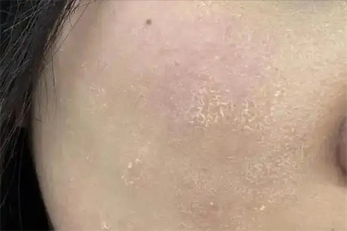 细节介绍