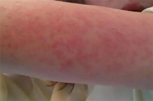 细节介绍