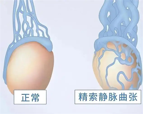 细节介绍