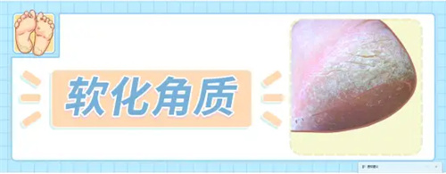 详细说明