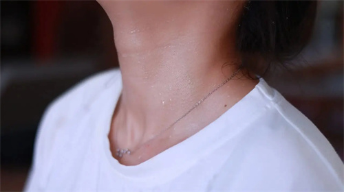 详细说明