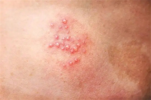 细节介绍