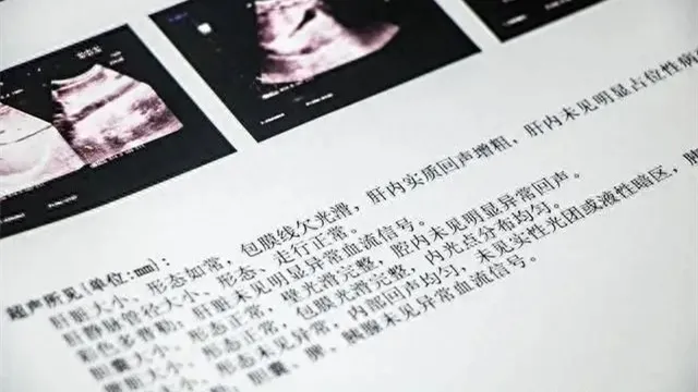 图片细节