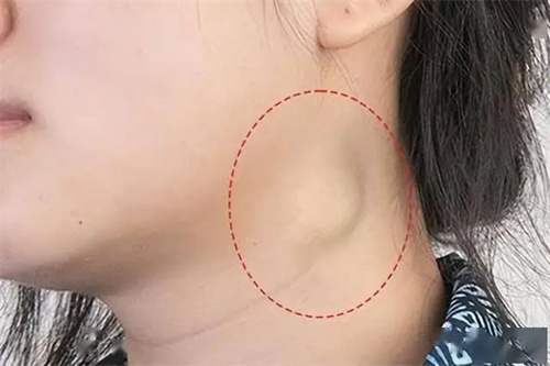 细节介绍