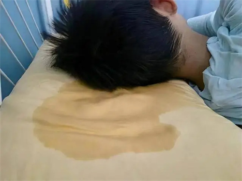 详细展示