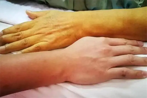 详细描述