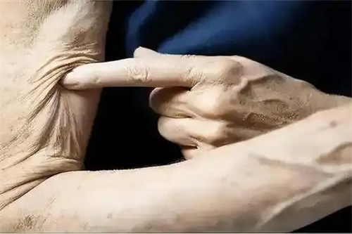 细节介绍
