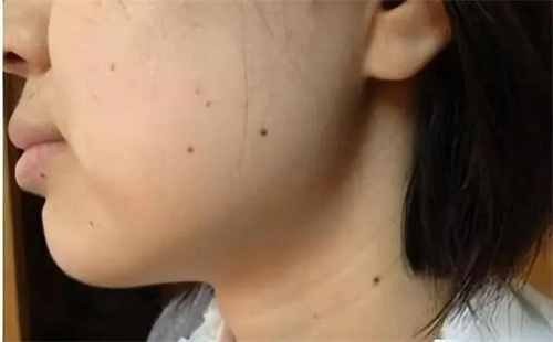 细节描述