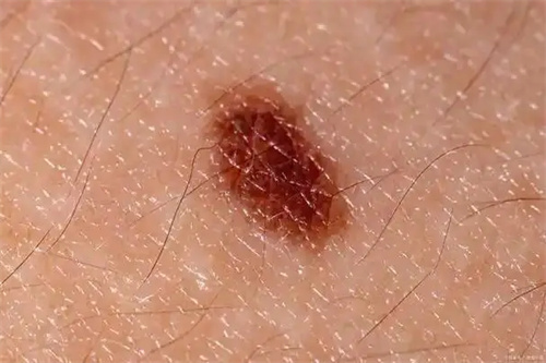 详细说明