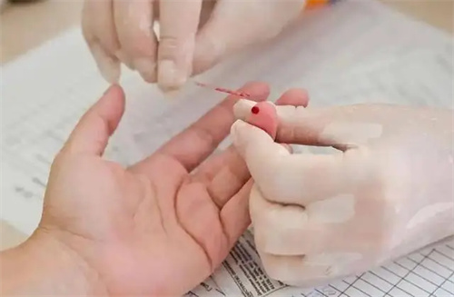详细说明