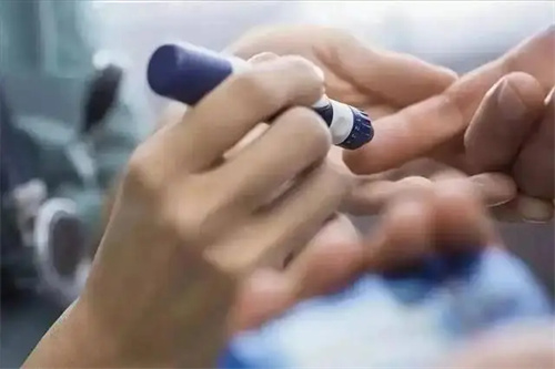细节介绍