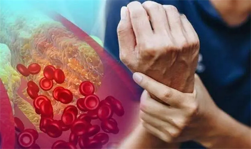详细说明