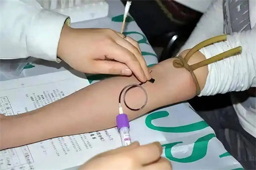 细节介绍