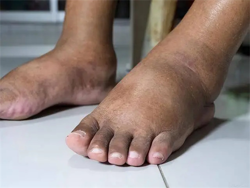 细节呈现