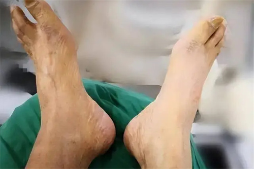 详细描述