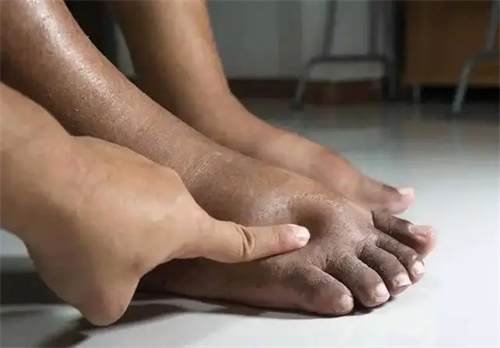 详细介绍